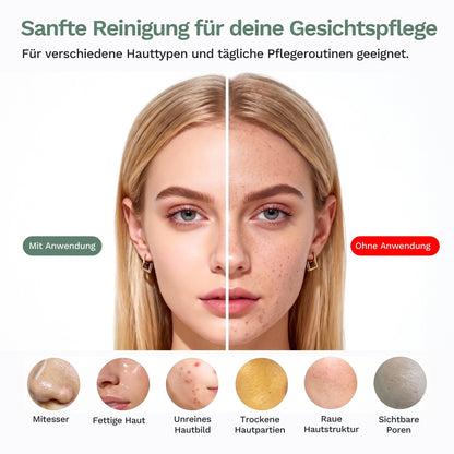 A split-face image of a young woman shows clearer skin on the left, labeled "Mit Anwendung der Lazurec Care 083 Gesichtsreinigungsbürste mit Wärme- & Kühlfunktion," while the right, "Ohne Anwendung," shows blemishes; below are close-ups of skin issues in circles.