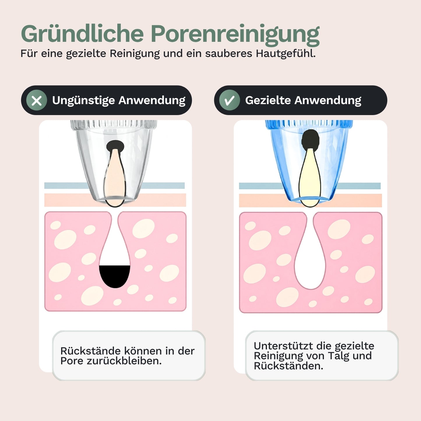 Porenreinigung-Infografik: gezielte Saugdüse zur Reinigung von Talg und Rückständen